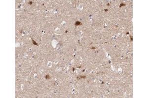 ABIN6266460 at 1/200 staining human Cerebellum tissue sections by IHC-P. (PAK3 抗体  (pSer154))