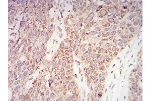 Immunohistochemistry (IHC) image for anti-V-Akt Murine Thymoma Viral Oncogene Homolog 1 (AKT1) (AA 1-150) antibody (ABIN5542264)