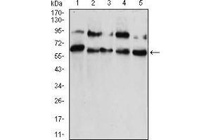 Western blot analysis using CBX2 mouse mAb against HUVEC (1), HEK293 (2), Hela (3), NIH/3T3 (4), and A431 (5) cell lysate. (CBX2 抗体  (AA 402-525))