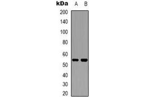Western blot analysis of Cytochrome P450 2W1 expression in Hela (A), HepG2 (B) whole cell lysates. (CYP2W1 抗体)