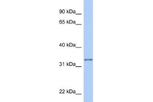 WB Suggested Anti-GSTO2 Antibody Titration:  0.