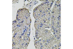 Immunohistochemistry of paraffin-embedded human stomach using CA9 antibody (ABIN6292666) at dilution of 1:100 (40x lens). (CA9 抗体)
