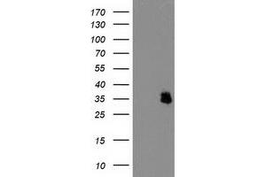 Western Blotting (WB) image for anti-Interferon-Induced Protein 35 (IFI35) antibody (ABIN1498802) (IFI35 抗体)