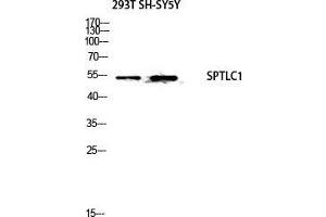 Western Blotting (WB) image for anti-serine Palmitoyltransferase, Long Chain Base Subunit 1 (SPTLC1) (C-Term) antibody (ABIN3187765)