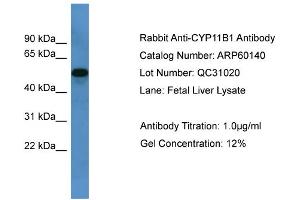 Western Blotting (WB) image for anti-Cytochrome P450, Family 11, Subfamily B, Polypeptide 1 (CYP11B1) (C-Term) antibody (ABIN2788349)