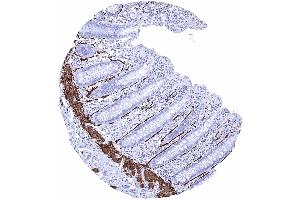 Appendix mucosa Intense caldesmon h positivity of intestinal subepithelial myofibroblasts ISEMFs and of the muscularis mucosae Caldesmon h immunohistochemistry (Recombinant Caldesmon 抗体)