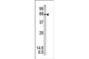 Image no. 1 for anti-Signal Transducer and Activator of Transcription 1, 91kDa (STAT1) (pSer727) antibody (ABIN358231)