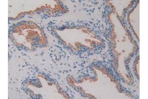 IHC-P analysis of Human Prostate Gland Tissue, with DAB staining. (DPP4 抗体  (AA 484-728))