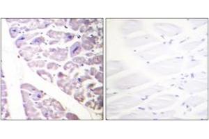 Immunohistochemistry analysis of paraffin-embedded human heart, using IKK-alpha (Phospho-Ser176) /IKK-beta (Phospho-Ser177) Antibody. (IKK alpha 抗体  (pSer176))