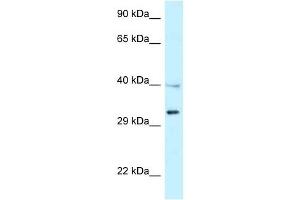 Western Blot showing TNFRSF14 antibody used at a concentration of 1 ug/ml against NCI-H226 Cell Lysate (HVEM 抗体  (Middle Region))