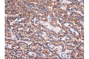 Image no. 1 for anti-Carboxypeptidase A1 (Pancreatic) (CPA1) (AA 1-419) antibody (ABIN1490771) (CPA1 抗体  (AA 1-419))