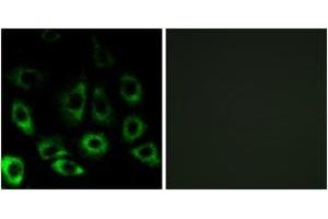 Immunofluorescence (IF) image for anti-Membrane-Bound Transcription Factor Peptidase, Site 2 (MBTPS2) (AA 301-350) antibody (ABIN2890405) (MBTPS2 抗体  (AA 301-350))