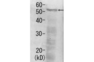 Western Blotting (WB) image for anti-Proteasome (Prosome, Macropain) 26S Subunit, Non-ATPase, 12 (PSMD12) antibody (ABIN2452114)