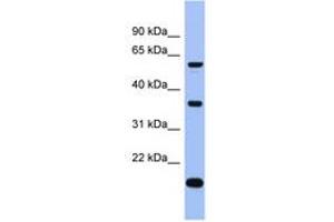 Image no. 1 for anti-La Ribonucleoprotein Domain Family, Member 6 (LARP6) (C-Term) antibody (ABIN6743023) (LARP6 抗体  (C-Term))