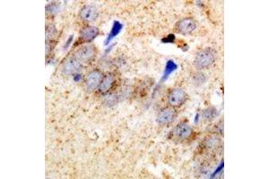 Immunohistochemical analysis of EEF1D staining in rat brain  formalin fixed paraffin embedded tissue section. (EEF1D 抗体)