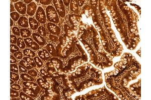 ABIN6259812 and ABIN6272986 at 1/100 staining Rat colon tissue by IHC-P. (ADRM1 抗体  (Internal Region))