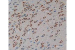 IHC-P analysis of Rat Brain Tissue, with DAB staining. (豚鼠 anti-兔 IgG Antibody (HRP))