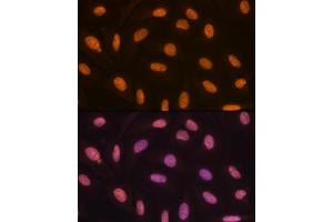 Immunofluorescence analysis of U-2 OS cells using KDM4B/JMJD2B Rabbit mAb (ABIN7268329) at dilution of 1:100 (40x lens). (KDM4B 抗体)