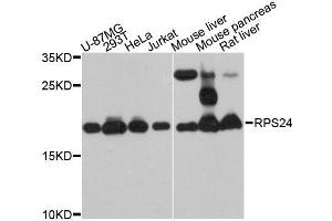 Western blot analysis of extracts of various cell lines, using RPS24 antibody (ABIN5998724) at 1:3000 dilution. (RPS24 抗体)