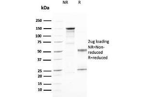 SDS-PAGE Analysis Purified CD25 Mouse Monoclonal Antibody (IL2RA/2394). (CD25 抗体  (AA 42-183))