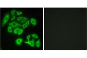 Immunofluorescence analysis of A549 cells, using FZD4 Antibody. (FZD4 抗体  (AA 131-180))