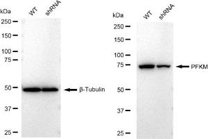 Western blotting analysis using PFKM antibody (ABIN7799801). (Recombinant PFKM 抗体)