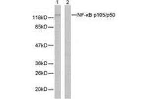 Western blot analysis of extracts from MDA-MB-435 cells, using NF-kappaB p105/p50 (Ab-337) Antibody. (NFKB1 抗体  (AA 304-353))