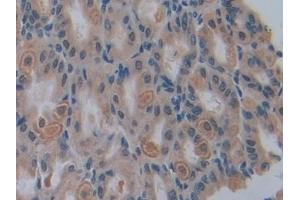 Detection of CASP12 in Mouse Stomach Tissue using Polyclonal Antibody to Caspase 12 (CASP12)