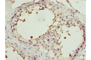 Immunohistochemistry (IHC) image for anti-Protein Phosphatase 1, Regulatory Subunit 7 (PPP1R7) (AA 2-280), (Regulatory Subunit 7) antibody (ABIN7165937)