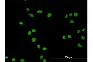 Immunofluorescence of monoclonal antibody to MCM7 on HeLa cell. (MCM7 抗体  (AA 1-389))