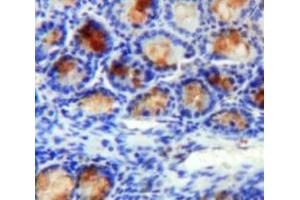 #VALUE! (Annexin A2 抗体  (AA 1-339))