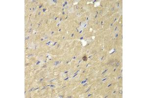 Immunohistochemistry of paraffin-embedded mouse heart using AKR7A2 antibody at dilution of 1:100 (400x lens). (AKR7A2 抗体)