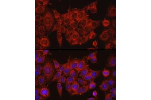 Immunofluorescence (IF) image for anti-Isocitrate Dehydrogenase 1 (NADP+), Soluble (IDH1) (AA 1-414) antibody (ABIN3023106)
