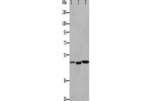 Gel: 10 % SDS-PAGE, Lysate: 40 μg, Lane 1-3: Mouse kidney tissue, Mouse brain tissue, Mouse heart tissue, Primary antibody: ABIN7190922(HCRTR2 Antibody) at dilution 1/1100, Secondary antibody: Goat anti rabbit IgG at 1/8000 dilution, Exposure time: 90 seconds (HCRTR2 抗体)