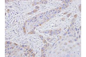IHC-P Image Immunohistochemical analysis of paraffin-embedded SCC15 xenograft, using TROVE2, antibody at 1:100 dilution. (TROVE2 抗体  (Center))