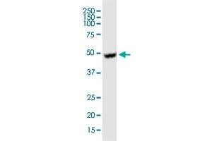 UGCG monoclonal antibody (M03), clone 1E5. (UGCG 抗体  (AA 33-131))