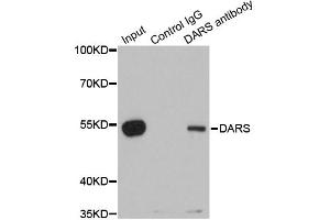 Immunoprecipitation analysis of 200ug extracts of 293T cells using 1ug DARS antibody. (DARS 抗体)