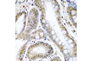 Immunohistochemistry (IHC) image for anti-Tumor Necrosis Factor (Ligand) Superfamily, Member 10 (TNFSF10) (AA 39-250) antibody (ABIN3023015)