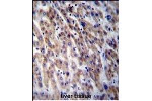 CPN1 Antibody (Center) (ABIN656809 and ABIN2846023) immunohistochemistry analysis in formalin fixed and paraffin embedded human liver tissue followed by peroxidase conjugation of the secondary antibody and DAB staining. (CPN1 抗体  (AA 210-240))