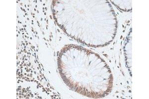 Immunohistochemistry (Paraffin-embedded Sections) (IHC (p)) image for anti-Zinc Finger Protein 148 (ZNF148) antibody (ABIN7262943)