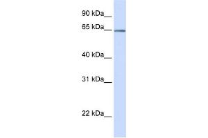 WB Suggested Anti-OPTN Antibody Titration:  0.