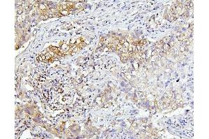IHC analysis of EIF4A using anti-EIF4A antibody (ABIN7601309).