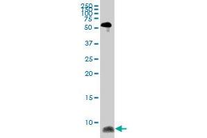 ATOX1 monoclonal antibody (M08), clone 4D6. (ATOX1 抗体  (AA 1-68))