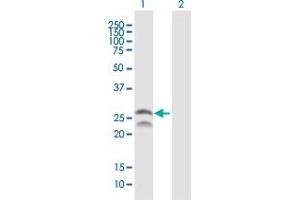 Western Blot analysis of FEV expression in transfected 293T cell line by FEV MaxPab polyclonal antibody. (FEV 抗体  (AA 1-238))