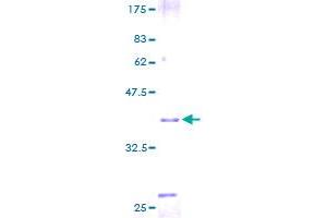 Trefoil Factor 2 (TFF2) (AA 1-129) protein (GST tag)