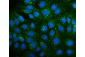 IF analysis of ABAT using anti-ABAT antibody (ABIN4886408). (ABAT 抗体  (AA 388-500))