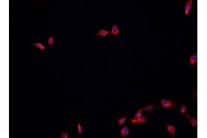 ABIN6278174 staining HepG2? (FOXA1 抗体  (C-Term))