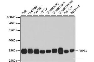 Western blot analysis of extracts of various cell lines using PRPS1 Polyclonal Antibody at dilution of 1:1000. (PRPS1 抗体)