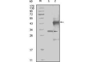 Western Blot showing EphA4 antibody used against truncated Trx-EphA4 recombinant protein (1) and truncated GST-EphA4 (aa777-986) recombinant protein (2). (EPH Receptor A4 抗体  (AA 777-986))