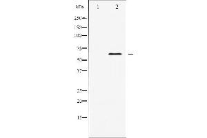 Western blot analysis of Elk1 expression in heatshock treated HeLa whole cell lysates,The lane on the left is treated with the antigen-specific peptide.